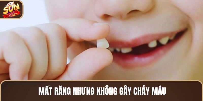 mat-rang-nhung-khong-gay-chay-mau